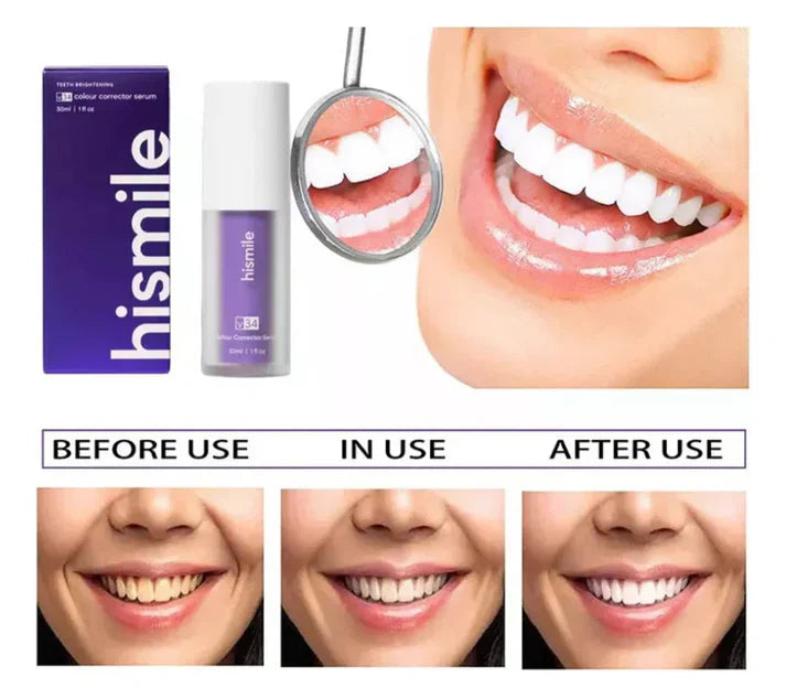 HISMILE v34 - Crema dental blanqueadora
