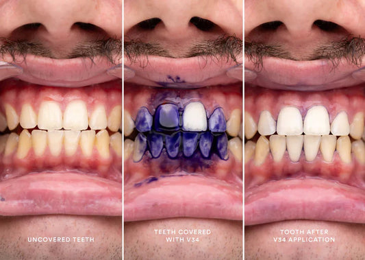 HISMILE v34 - Crema dental blanqueadora
